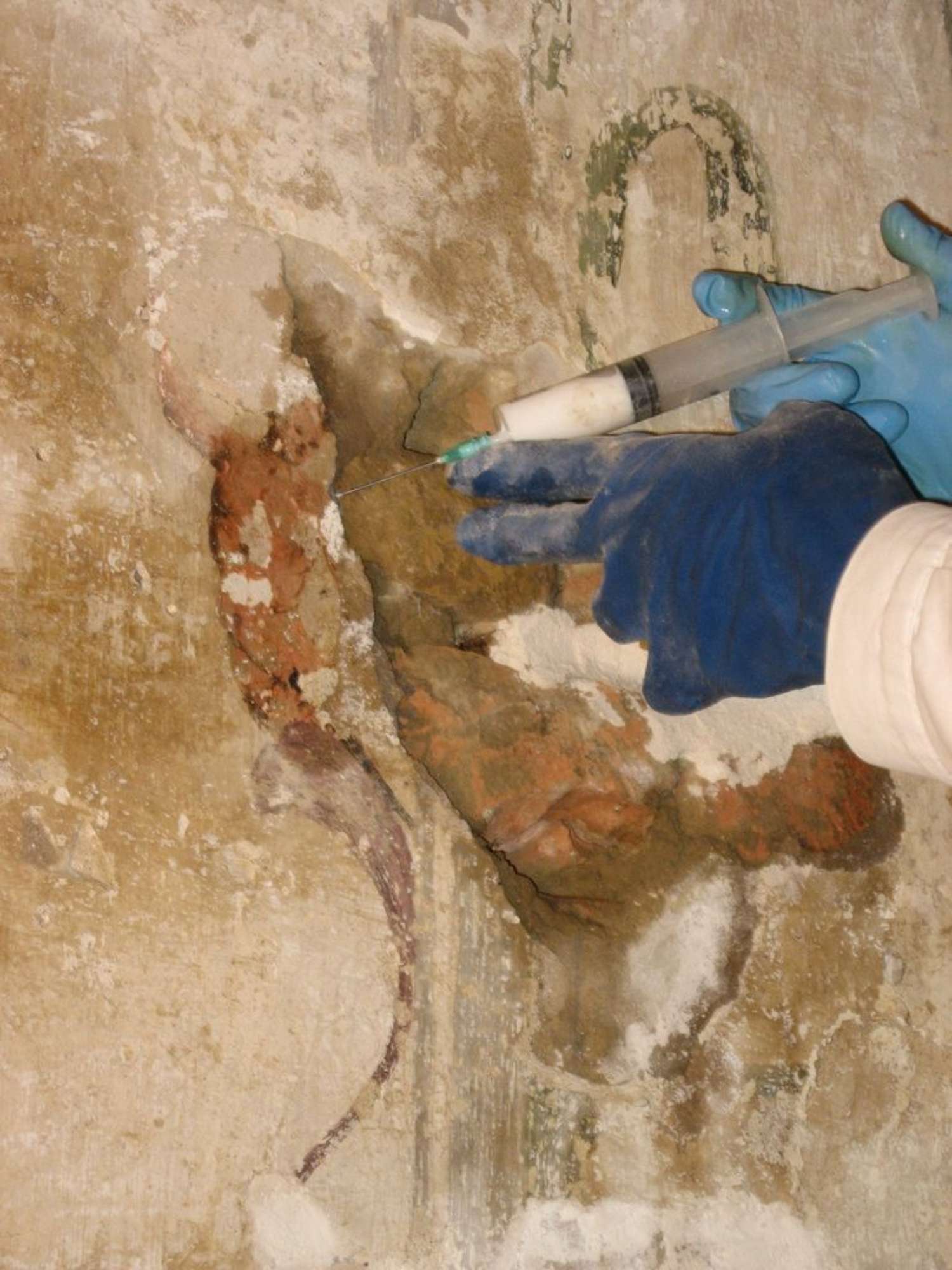 iniezioni a resina acrilica 